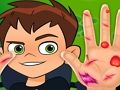 Spil Ben10 håndlæge  online