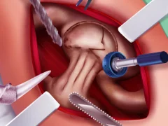 Spil Princess Hips Surgery online
