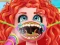 Spil Treating stuck fish bone online