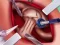 Spil Princess Hips Surgery online