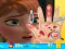 Spil Anna hand doctor online