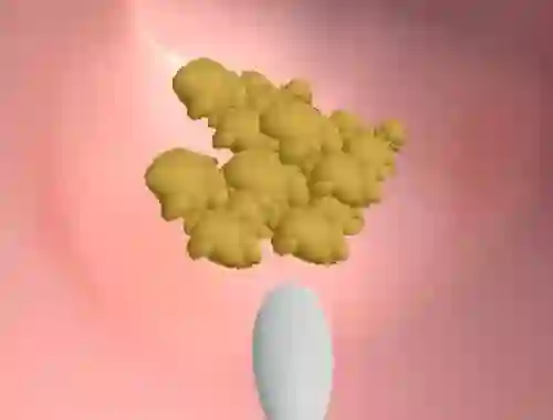 Spil Earwax Clinic online