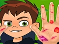 Spil Ben10 håndlæge  online